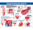 092_1300х1000 - предстательная железа